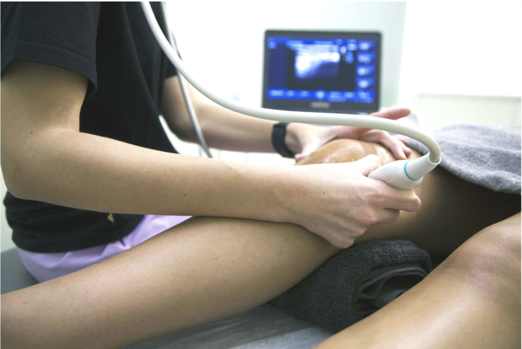 ECOGRAFÍA EN FISIOTERAPIA: EL ALIADO DE PRECISIÓN PARA EL DIAGNÓSTICO